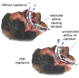 Airflow without and with appliance